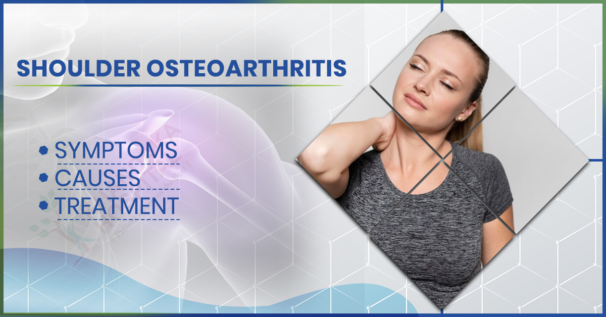 Shoulder Osteoarthritis: Symptoms, Causes & Treatment